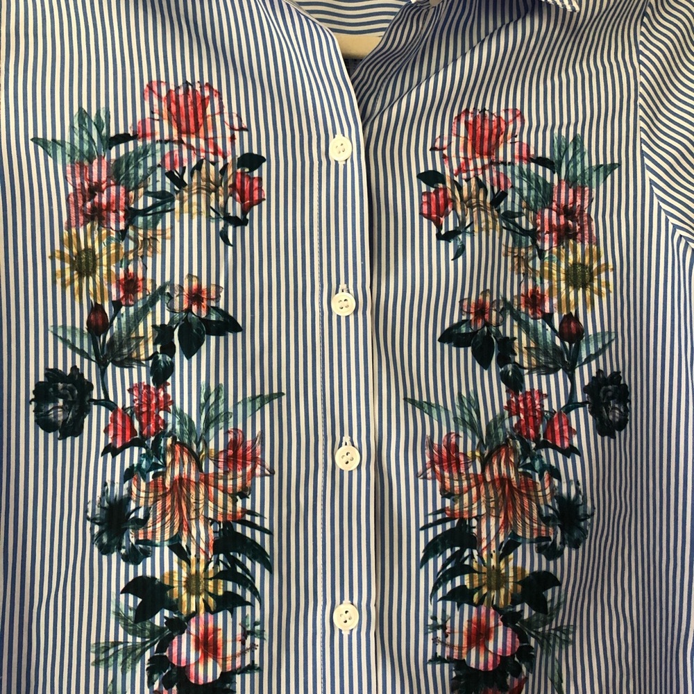 Button up top - Picture 2 of 5